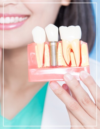 Dental Implants Near Me in Woodbridge, NJ