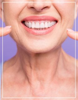Teeth Whitening Near Me in Woodbridge, NJ