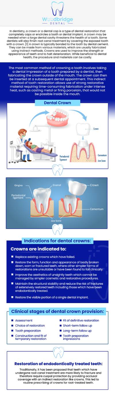 Common questions asked by patients: What is a dental crown, and why do I need one? How long do dental crowns last? What materials are dental crowns made from? Am I a good candidate for a dental crown? For more information, contact us or schedule an appointment online. We are conveniently located at 850 Woodbridge Center Dr. Woodbridge, NJ 07095.