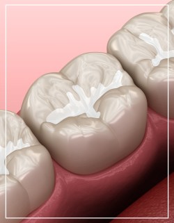 Dental Filling Near Me in Woodbridge, NJ