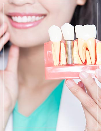 Dental Implants Near Me in Woodbridge, NJ