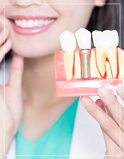 Dental Implants Near Me in Woodbridge, NJ