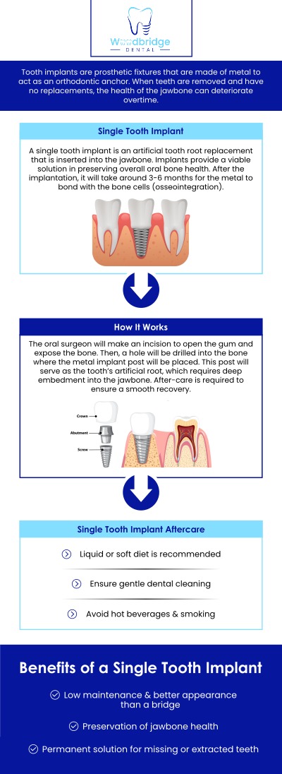 Common questions asked by patients: What does a same day tooth implant dentist do? How can a same day tooth implant dentist replace my tooth in one visit? Is the procedure painless with a same day tooth implant dentist? How long does a same day tooth implant dentist take to complete treatment? For more information, contact us or schedule an appointment online. We are conveniently located at 850 Woodbridge Center Dr. Woodbridge, NJ 07095.
