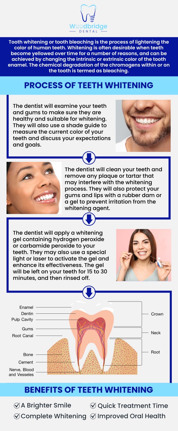 Common questions asked by patients: How does teeth whitening work? Is teeth whitening safe for my teeth and gums? How long does the teeth whitening process take? How long do whitening results last? For more information, contact us or schedule an appointment online. We are conveniently located at 850 Woodbridge Center Dr. Woodbridge, NJ 07095.