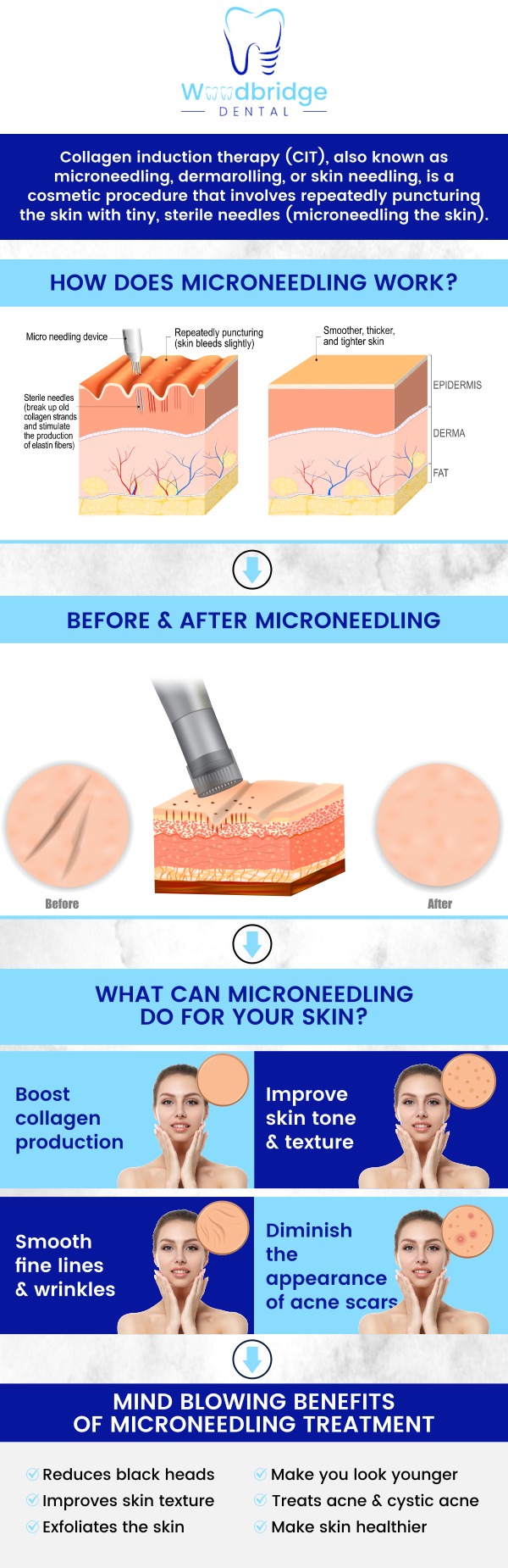 At Woodbridge Dental, our microneedling treatment helps reveal your healthiest, most radiant skin. Using advanced Dermapen® technology, we stimulate natural collagen production for smoother, youthful-looking skin. Enhance texture, tone, and overall radiance with our safe, minimally invasive microneedling sessions. For more information, contact us or schedule an appointment online. We are conveniently located at 850 Woodbridge Center Dr. Woodbridge, NJ 07095. At Woodbridge Dental, our microneedling treatment helps reveal your healthiest, most radiant skin. Using advanced Dermapen® technology, we stimulate natural collagen production for smoother, youthful-looking skin. Enhance texture, tone, and overall radiance with our safe, minimally invasive microneedling sessions. For more information, contact us or schedule an appointment online. We are conveniently located at 850 Woodbridge Center Dr. Woodbridge, NJ 07095.