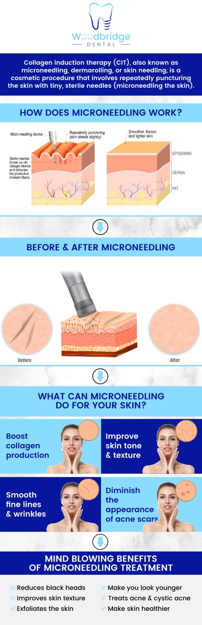 At Woodbridge Dental, our microneedling treatment helps reveal your healthiest, most radiant skin. Using advanced Dermapen® technology, we stimulate natural collagen production for smoother, youthful-looking skin. Enhance texture, tone, and overall radiance with our safe, minimally invasive microneedling sessions. For more information, contact us or schedule an appointment online. We are conveniently located at 850 Woodbridge Center Dr. Woodbridge, NJ 07095. At Woodbridge Dental, our microneedling treatment helps reveal your healthiest, most radiant skin. Using advanced Dermapen® technology, we stimulate natural collagen production for smoother, youthful-looking skin. Enhance texture, tone, and overall radiance with our safe, minimally invasive microneedling sessions. For more information, contact us or schedule an appointment online. We are conveniently located at 850 Woodbridge Center Dr. Woodbridge, NJ 07095.