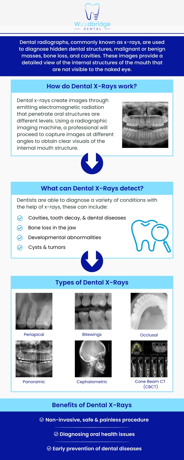 Common questions asked by patients: Why are dental X-rays important for maintaining oral health? What types of dental X-rays are commonly used during a dental examination? How often should I get dental X-rays for routine dental care? Are dental X-rays safe, and how much radiation exposure is involved? What can a dentist detect through dental X-ray imaging? How does Woodbridge Dental LLC provide accurate dental X-ray services in Woodbridge, NJ? For more information, contact us or schedule an appointment online. We are conveniently located at 850 Woodbridge Center Dr. Woodbridge, NJ 07095. Common questions asked by patients: Why are dental X-rays important for maintaining oral health? What types of dental X-rays are commonly used during a dental examination? How often should I get dental X-rays for routine dental care? Are dental X-rays safe, and how much radiation exposure is involved? What can a dentist detect through dental X-ray imaging? How does Woodbridge Dental LLC provide accurate dental X-ray services in Woodbridge, NJ? For more information, contact us or schedule an appointment online. We are conveniently located at 850 Woodbridge Center Dr. Woodbridge, NJ 07095.